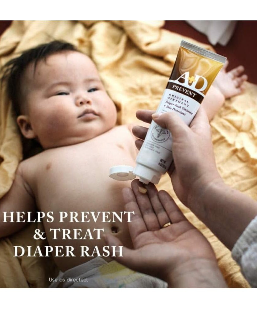 A+D Prevent Original Diaper Rash Ointment & Skin Protectant with Lanolin & Petrolatum – Prevents, Soothes & Moisturizes Baby Skin | 113g - MINIMEE KIDS